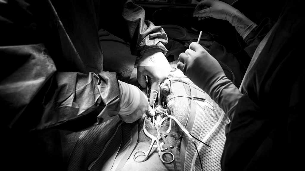 dual-spinal-surgery-wound-with-instruments