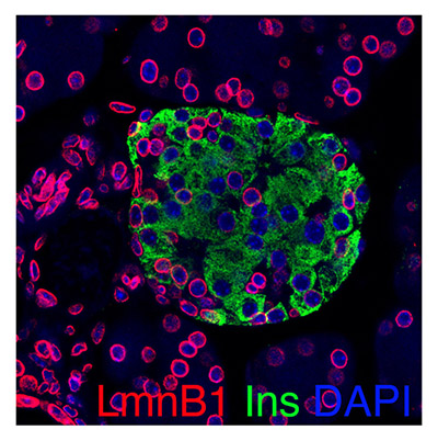 Beta-cells (green) in a pre-Type 1 diabetes model (NOD) are senescent, as determined by the loss of nuclear LmnB1.