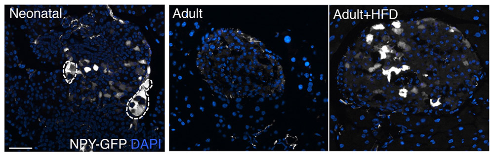Neuropeptide Y expression in pancreatic islets during growth and in response to high-fat diet (HFD) induced metabolic stress. Adapted from Rodnoi et al., 2017.