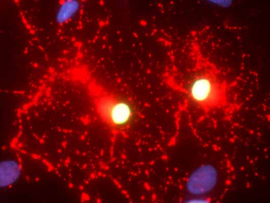 developing universal donor stem cells