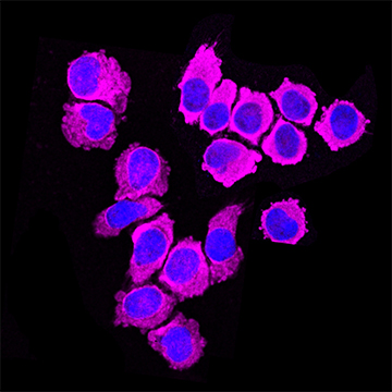 City of Hope researchers discovered that ILC2s can attack cancer cells.