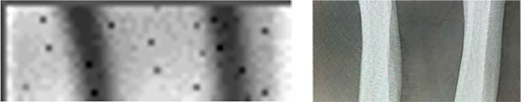 Reconstructed backscatter and equivalent transmission mode X-rays