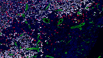 image of regulatory T cells homing into the thymus
