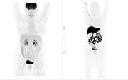 Nuclear Medicine, Diagnostic Radiology, scan
