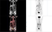Nuclear Medicine, Diagnostic Radiology, scan