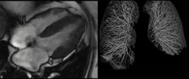 Cardiothoracic imaging