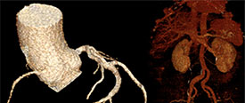 Cardiothoracic imaging