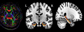 Neuroradiology, Diagnostic Radiology, scan