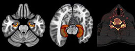 Neuroradiology, Diagnostic Radiology, scan