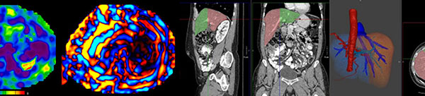 Abdominal imaging