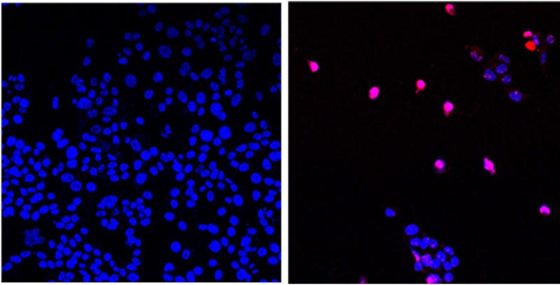 AOH1996 programmed cell death (Zen)