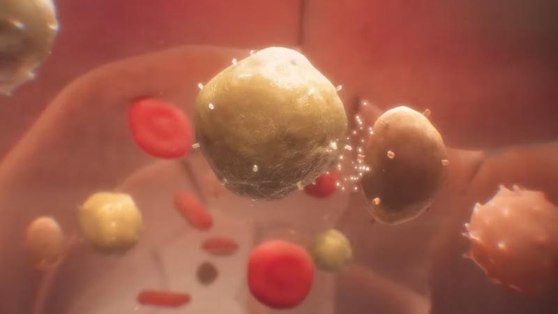CAR T cell therapy is one way City of Hope scientists are empowering a patient’s own immune system to fight cancer