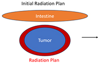 Ethos™ Therapy System Initial Radiation Plan