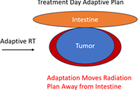 Ethos™ Therapy System Treatment Day Adaptive Plan
