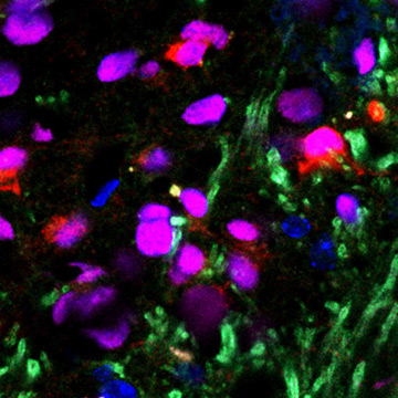 Research Spotlight - Yanhong Shi Lab