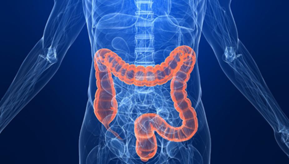 Colon outcomes