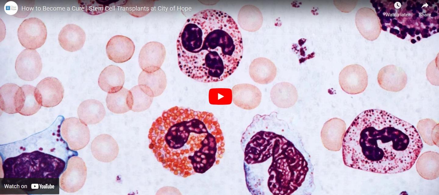 How to Become a Cure | Stem Cell Transplants at City of Hope