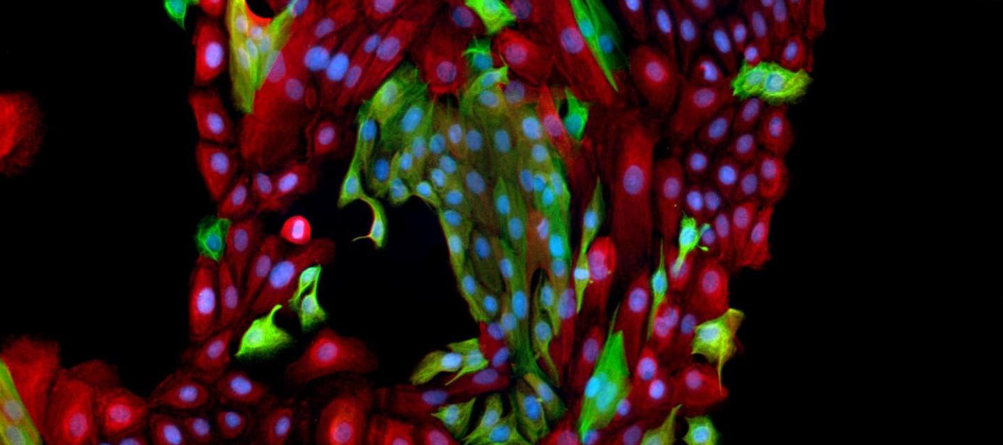 Primary HMEC Cell Culture