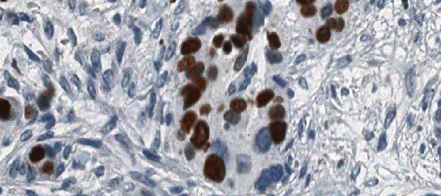 Population Facing Research - Cell Segmentation