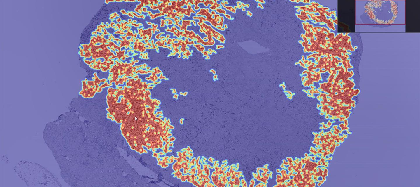 Population Facing Research - Deep Learing of Walking