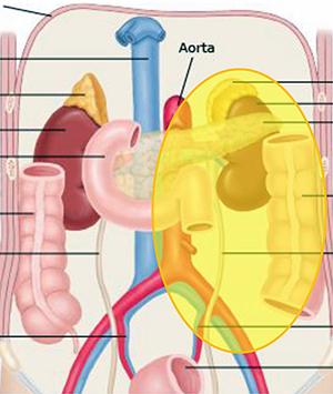 5 major histologic types for retroperitoneal sarcoma