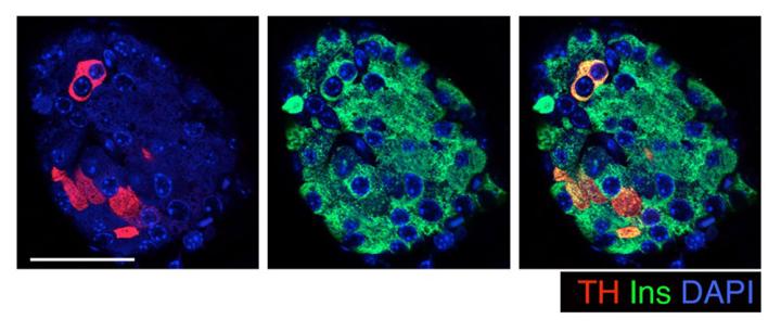 TH expression in pancreatic islets, illustrating beta-cell heterogeneity. Adapted from Parveen and Wang et al., 2023.