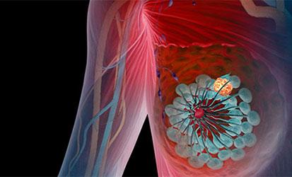 Breast and lymphatic anatomy 