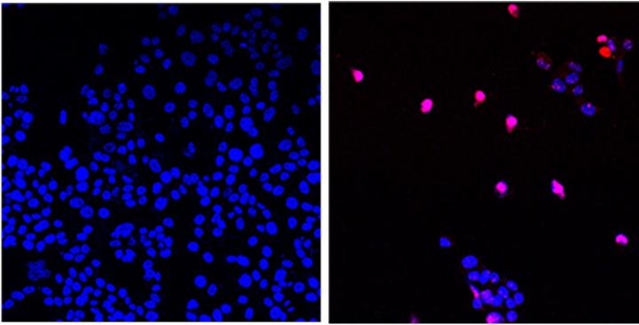 AOH1996 targets a cancerous variant of the protein  PCNA; programmed cell death