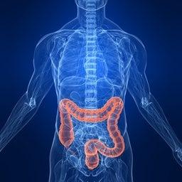 colorectal cancer screening