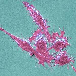 Colorectal cancer cells