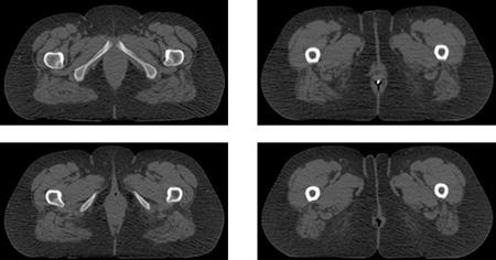 gi-ct-450x236
