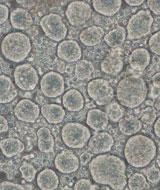 Islet Cells