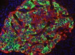 Islet Cells