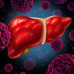 breakthroughs - liver cancer