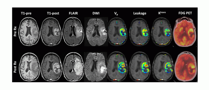 Mathematical Oncology Research Areas Fig 3