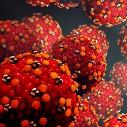 Measles Virus | City of Hope