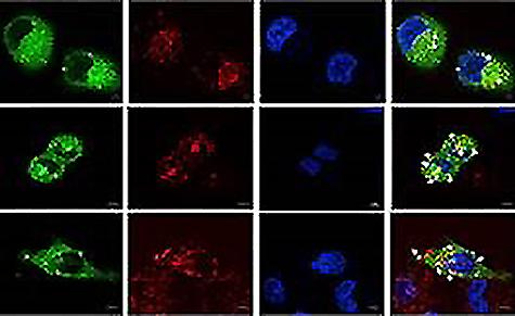 RNA synthesis - Center for RNA Biology and Therapeutics