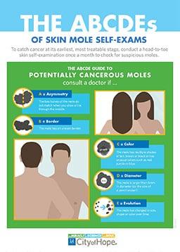 ABCDEs Skin Mole Self Exam Infographic ABCDEs Skin Mole Self Exam