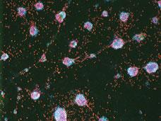 stem cells stem cells