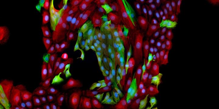Primary HMEC Cell Culture