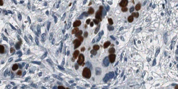 Population Facing Research - Cell Segmentation