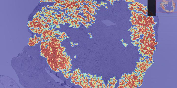 Population Facing Research - Deep Learing of Walking