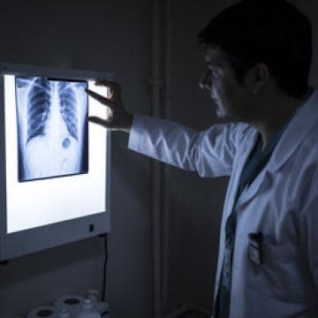 Cancer recurrence