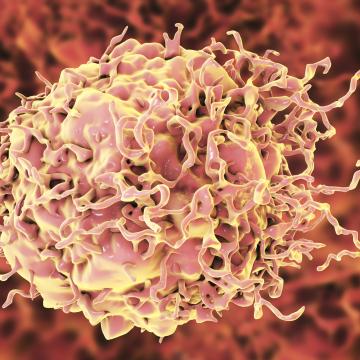 Red, orange and yellow colon cancer cell, computer illustration