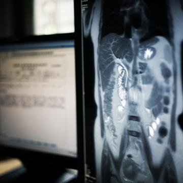 abdomen MRI image showing on medical monitor