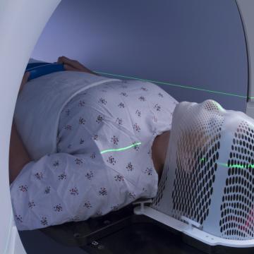 radiation therapy