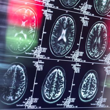 brain scans