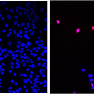 AOH1996 targets a cancerous variant of the protein  PCNA; programmed cell death