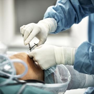 surgery stock photo