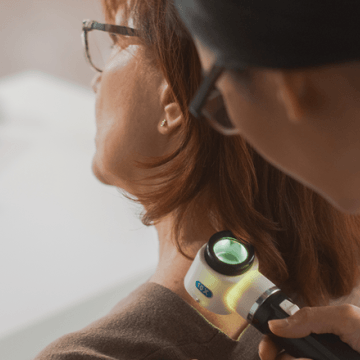 Skin cancer check